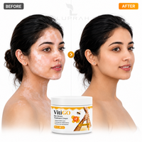 VitiGO Bee Venom Treatment Cream for White Spots & Skin Pigmentation Care | For Men & Women | 50g