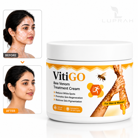VitiGO Bee Venom Treatment Cream 50g